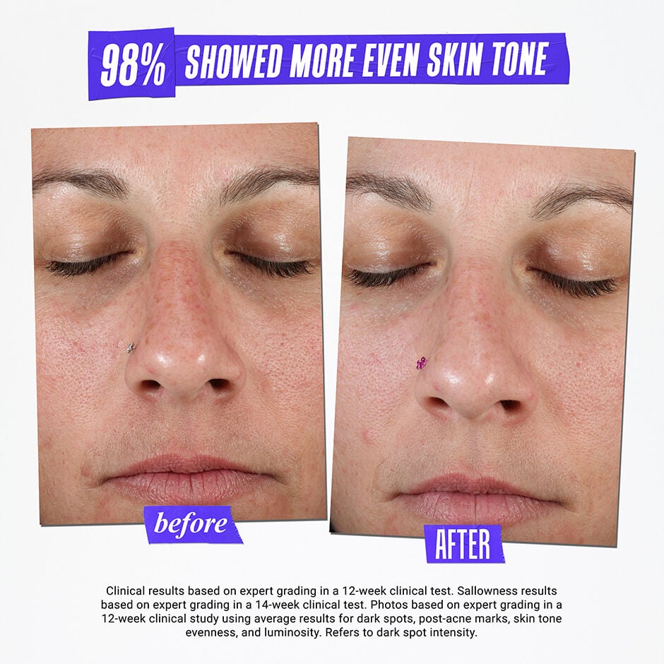 Clearly Corrective Dark Spot Solution - Dark Spot Serum